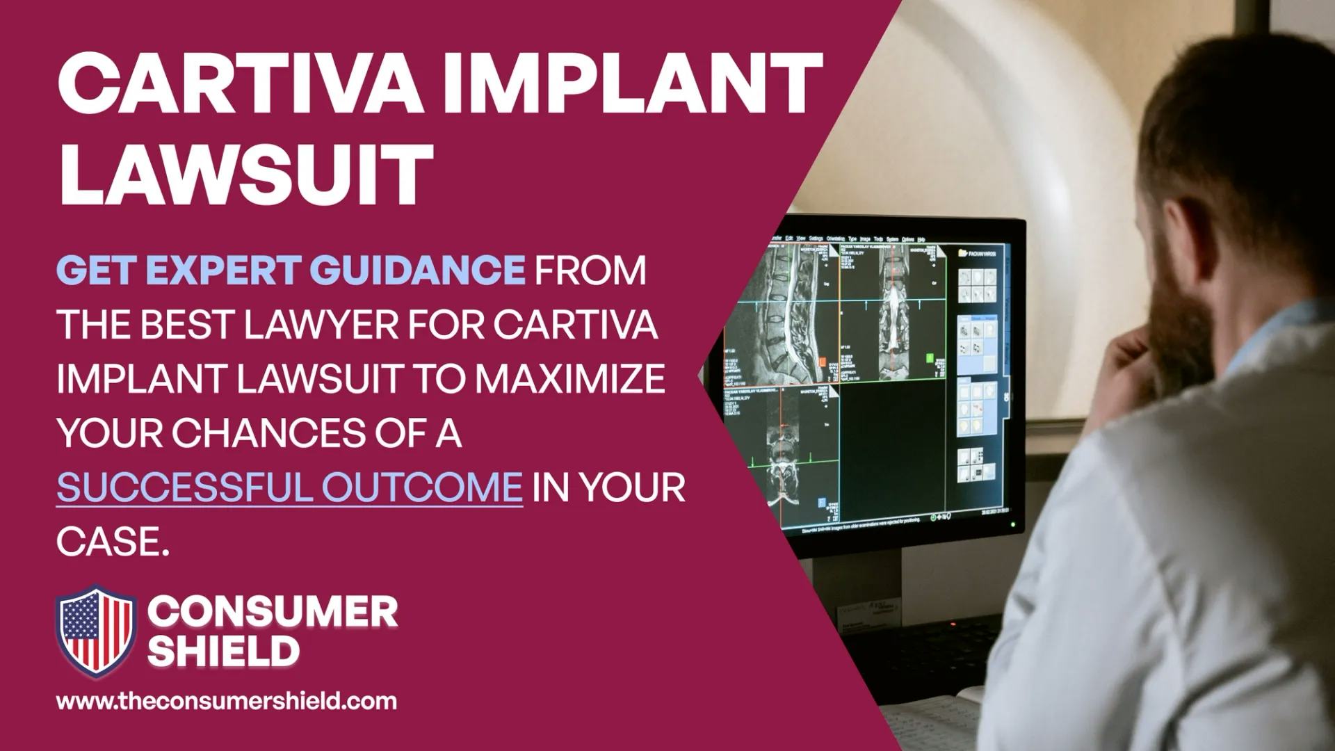 Do I Qualify for the Cartiva Implant Lawsuit?